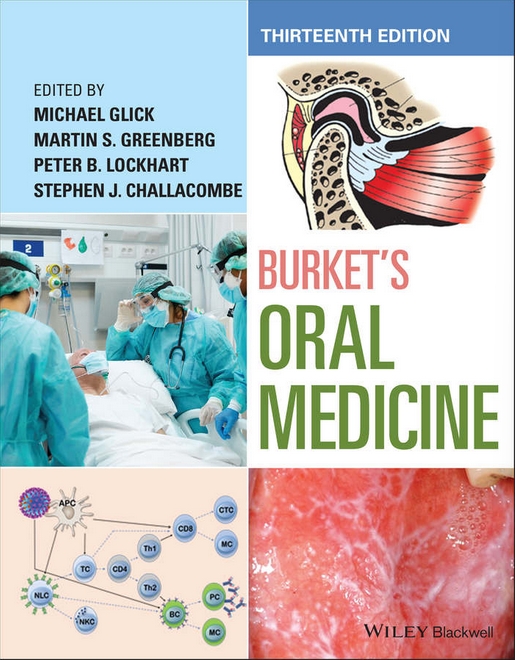 Burket’s Oral Medicine, 13th ed.